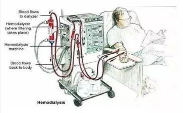 血液透析个人总结5篇